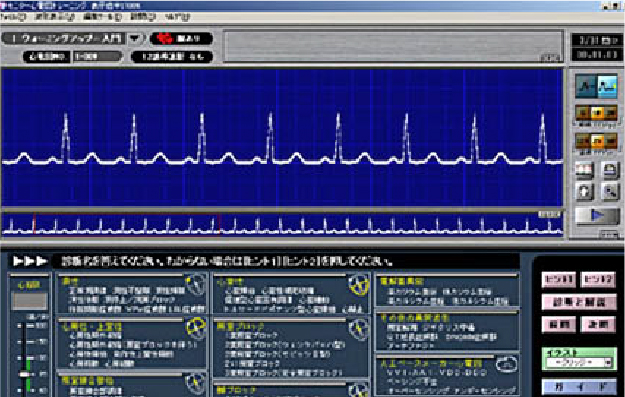 ECG Training Software